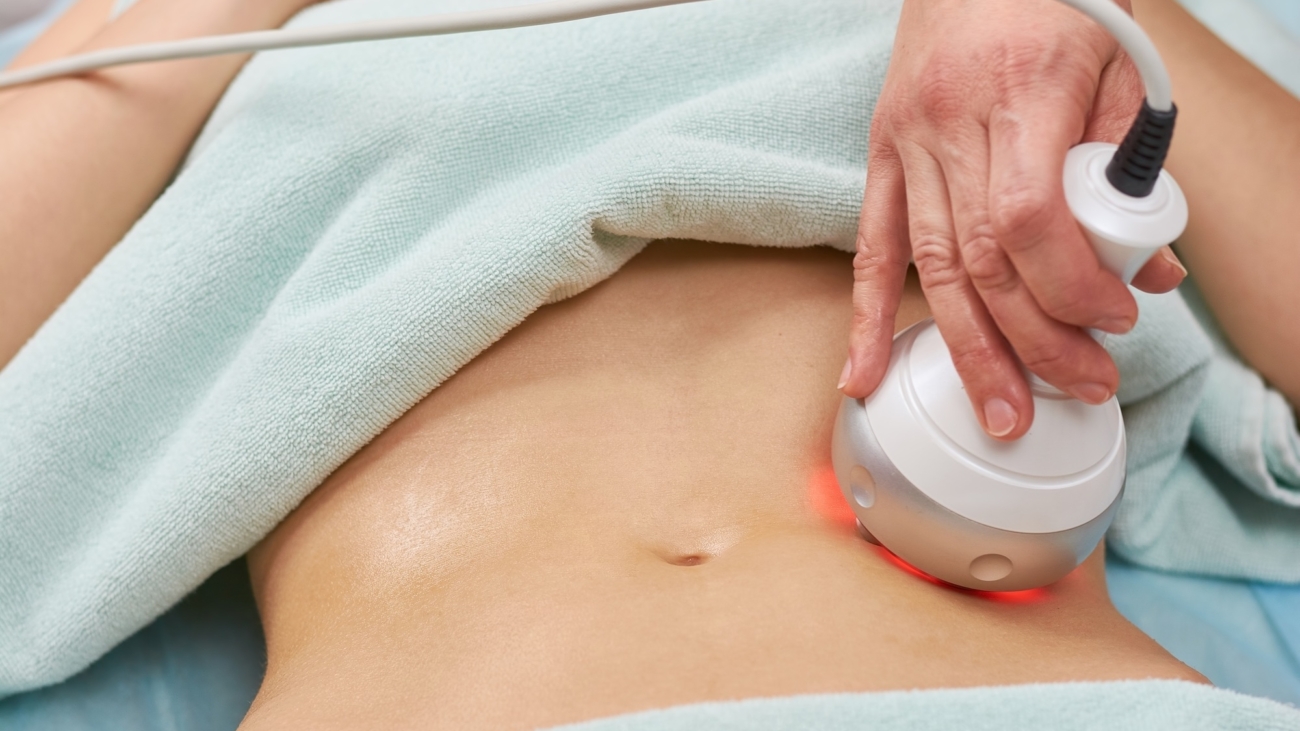 Rf skin tightening, belly